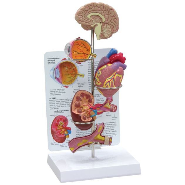 Modèle d&rsquo;hypertension artérielle