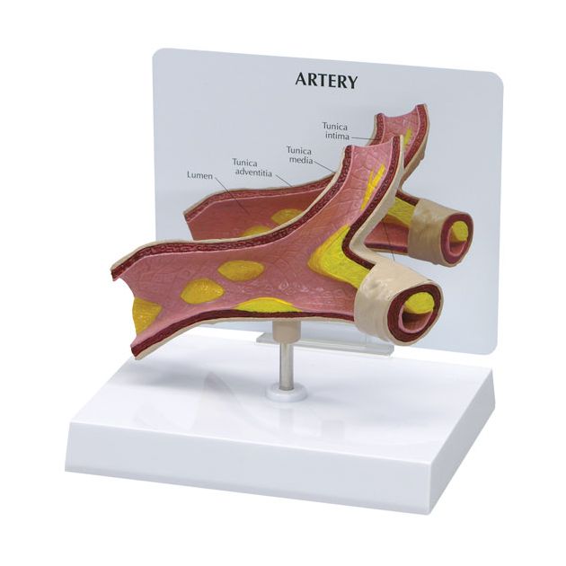 Modèle d&rsquo;artériosclérose, 1 pièce